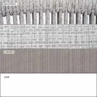 Sillón Garden Lounge tapizado en tela y aluminio - Smart by Varaschin viadurini